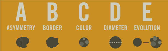 The ABCDE's of Skin Cancer and Melanoma