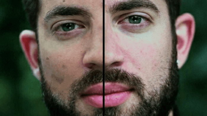 Dark Spots 101: Best Treatment Recommendations