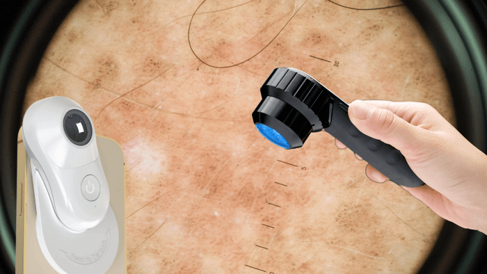 Case Study Family Medicine & Modern Ritual Health Dermatology Consultation