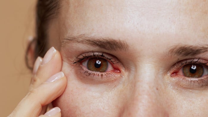 Allergies, or Something More? The Lowdown on the Recalled Lash and Brow Products…