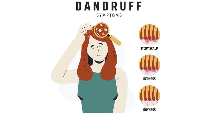 Dandruff Explained: Causes, Symptoms & Natural Remedies