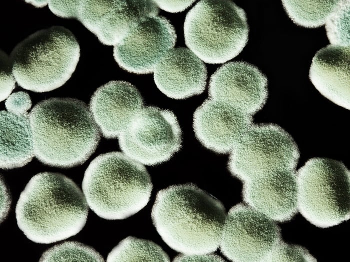 WHAT'S UP WITH MOLD IN COFFEE???