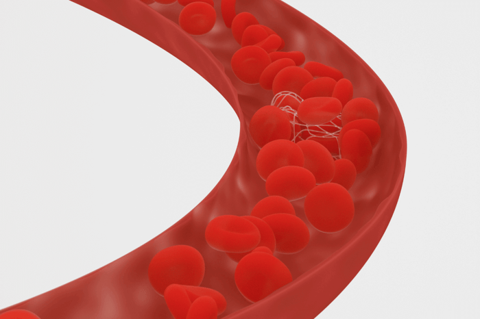 Blodkar og hjernen: Beskyt dig mod demens