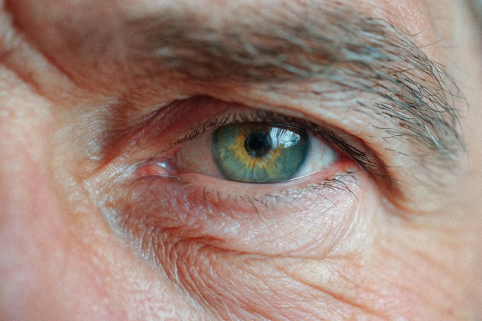 Tør AMD: Kosttilskud viser lovende effekt