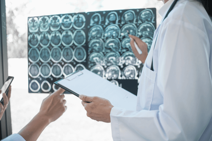 Har du plastik i hjernen? Ny forskning finder alarmerende mængder