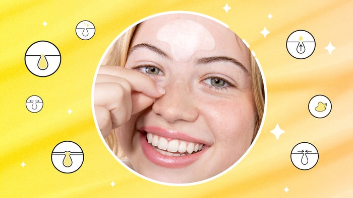 Is it bad to squeeze blackheads?