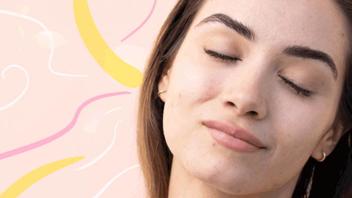 What is stress acne and how to treat it