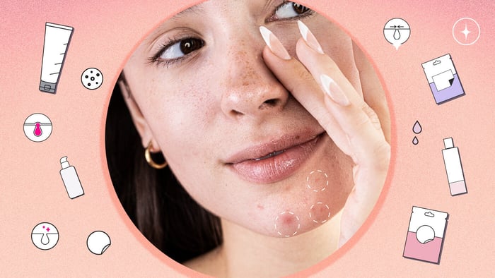 Why am I breaking out on my chin and what to do