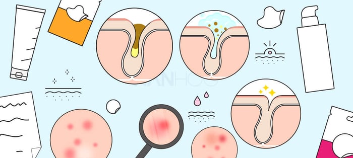 Why it's important to take care of your skin