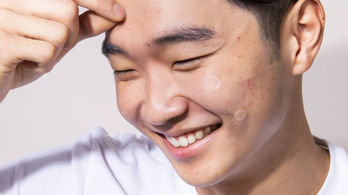 Pimple journey with patches (which patch to use at what stage of the pimple)