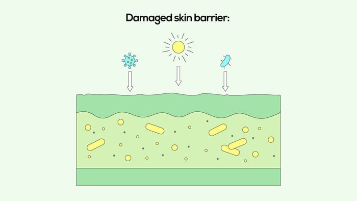 Signs of a damaged skin barrier