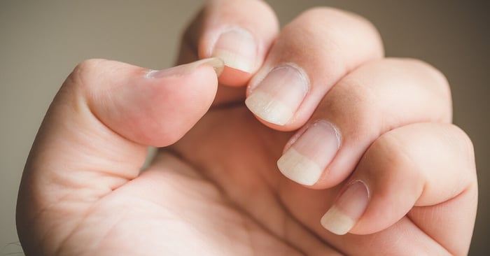 A person displays their unpolished and unbuffed natural fingernails closely under bright, even lighting.