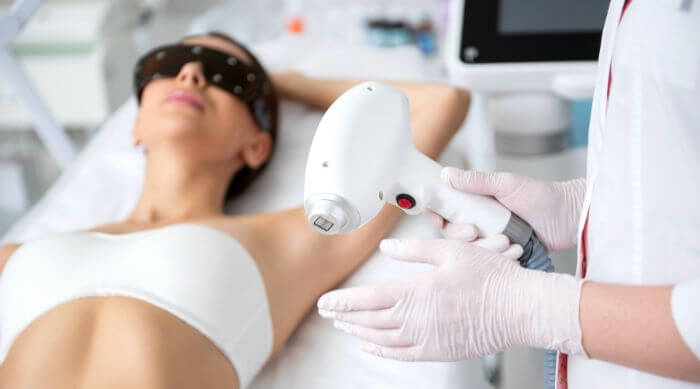 Laser Hair Removal 101