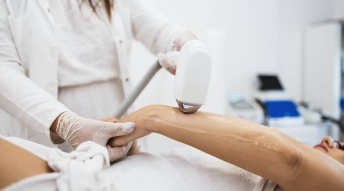 The Low Risks of Flashing: Side Effects of Laser Hair Removal