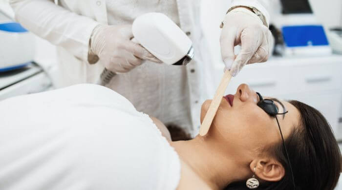 The Best Lasers for Hair Removal