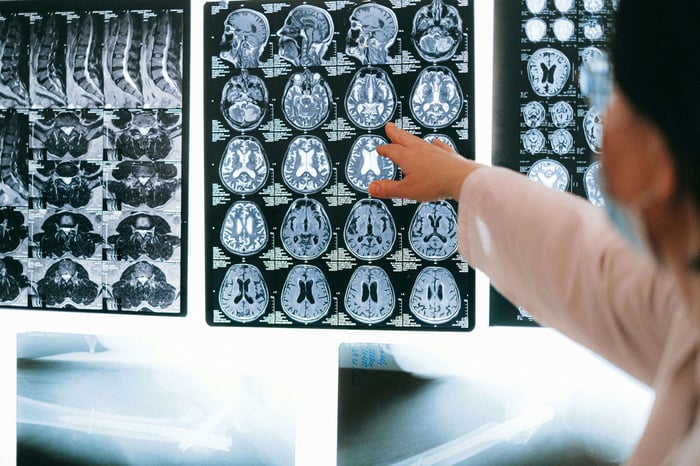 Understanding the Genetic Basis of Genetic Mental Health Issues