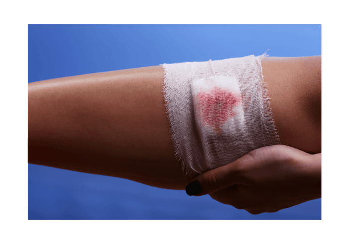 How to Stop Bleeding from a Cut