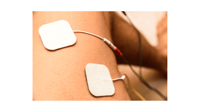 What is a TENS machine?