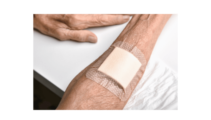 Wound Care Supplies for Home Healing