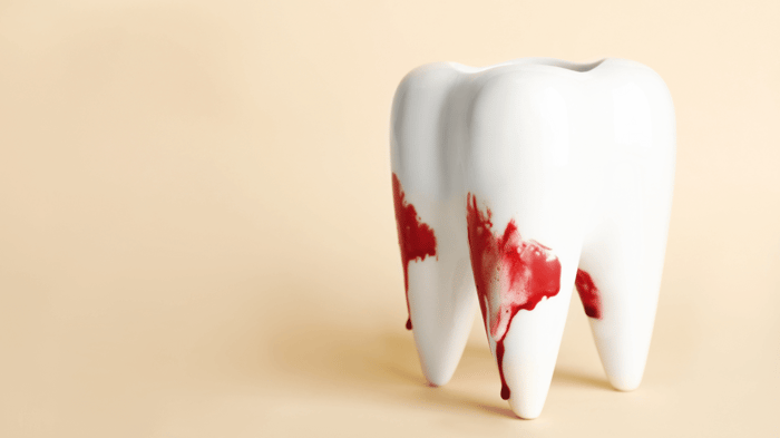 Gums Bleeding When Flossing: What to Do?