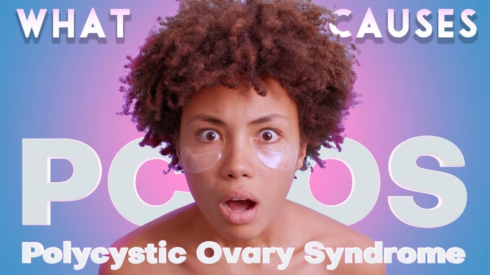 What causes Polycystic Ovary Syndrome PCOS? Symptoms & Signs