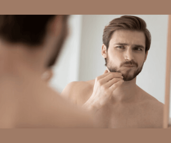 Preventing Beard Acne: Expert Tips & Product Recommendations