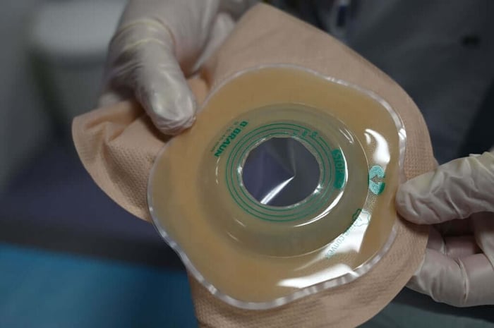 The Caregiver Guide – Living with an Ostomy