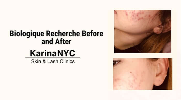 Biologique Recherche Before and After: Does It Work?