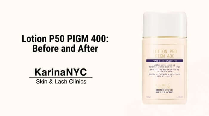 Lotion P50 PIGM 400 Before and After: Does It Work?