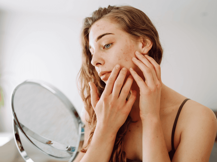 Skincare for Flaky Skin: Hydrate & Rebalance