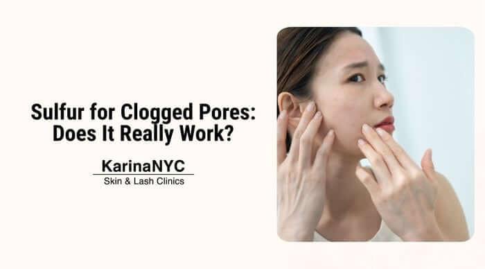 Sulfur for Clogged Pores: Does It Really Work?