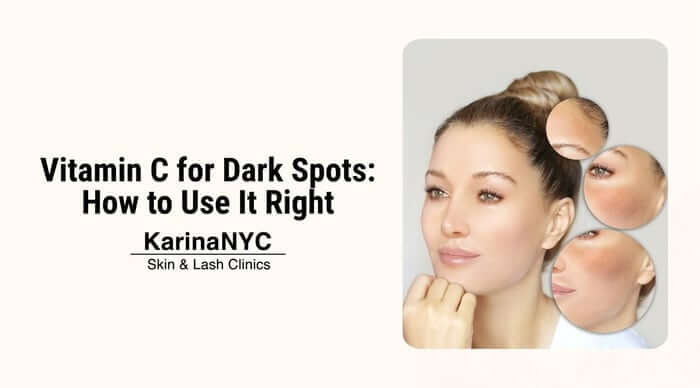 Vitamin C for Dark Spots: How to Use It Right