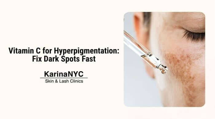 Vitamin C for Hyperpigmentation: Fix Dark Spots Fast
