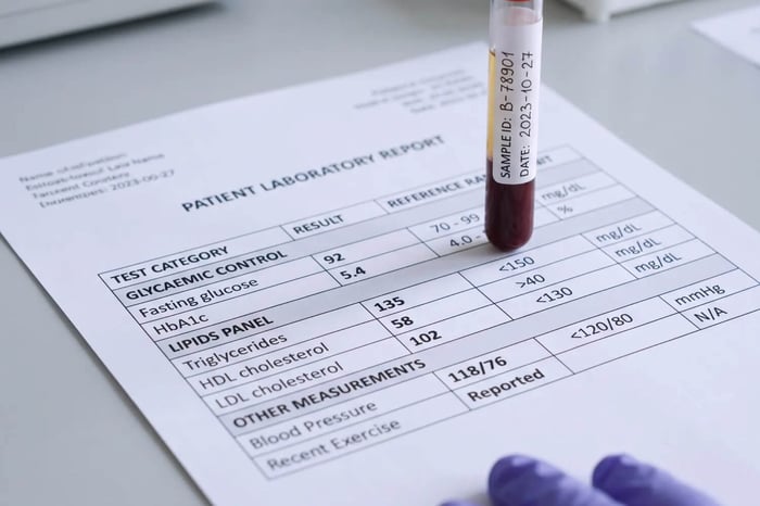 How To Read Your Lipid Panel: What Each Number Actually Means for Your Heart