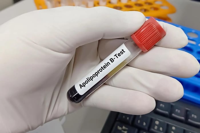 How To Lower Apolipoprotein B: Diet, Lifestyle, and What the Research Says