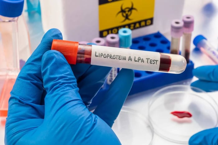 Elevated Lipoprotein(a): What It Means for Your Heart Health