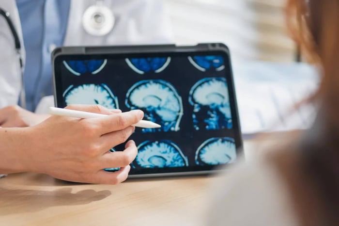 Nattokinase and Brain Health — The Emerging Research on Amyloid Plaques and Cognitive Aging