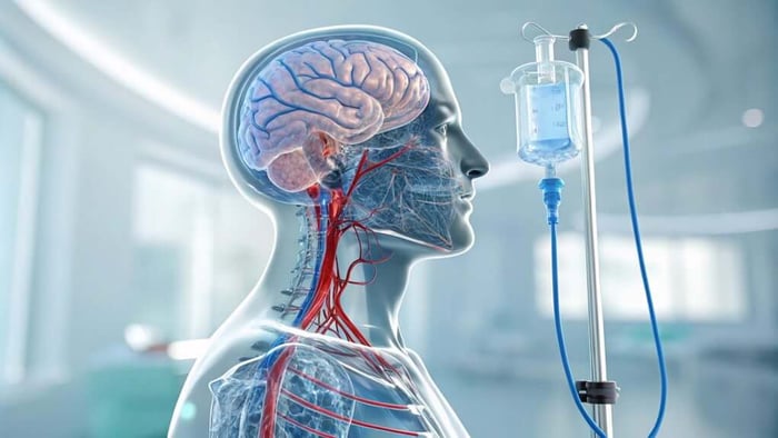 Medical illustration of human brain and IV infusion drip