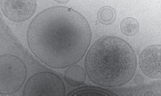 Cryo-electron microscopy image of EVs extracted from human ovarian cancer cells