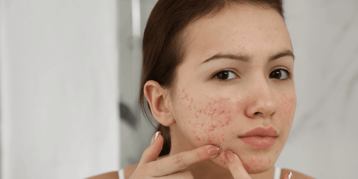 Skincare for kids with a simple tween-friendly skincare routine for sensitive skin