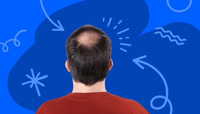 a man with hair loss and diabetes