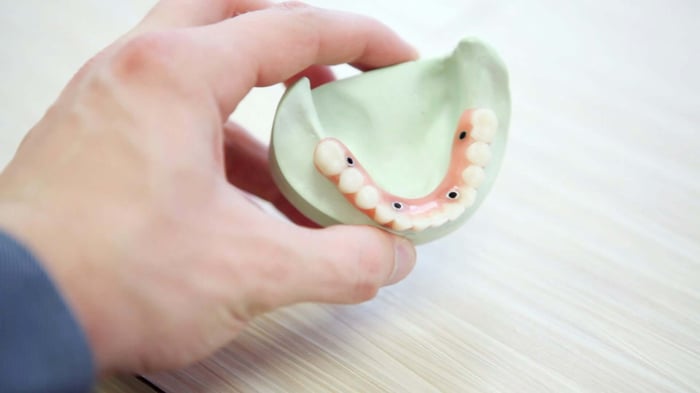 Dental Bridge Explained