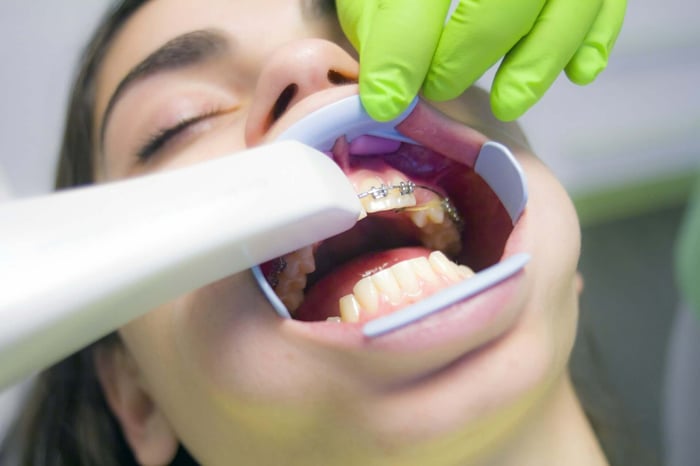 Adult patient undergoing orthodontic imaging with braces during a consultation comparing Invisalign vs Metal Braces for Adults
