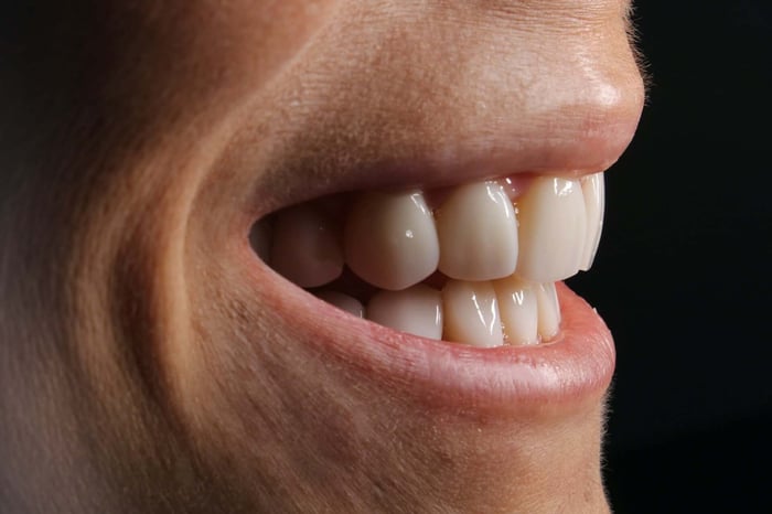 Close-up of a bright, healthy smile with aligned teeth, illustrating how a Night Guard For Teeth Grinding helps protect enamel