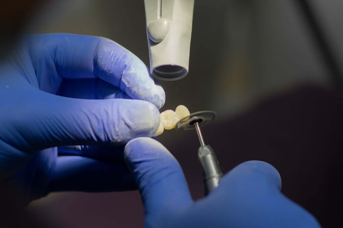Dental technician shaping and polishing a custom Dental Veneers restoration to enhance the appearance