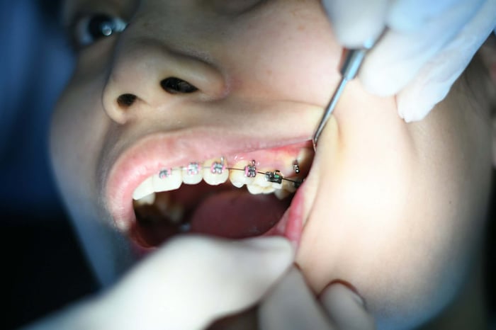 Child Braces