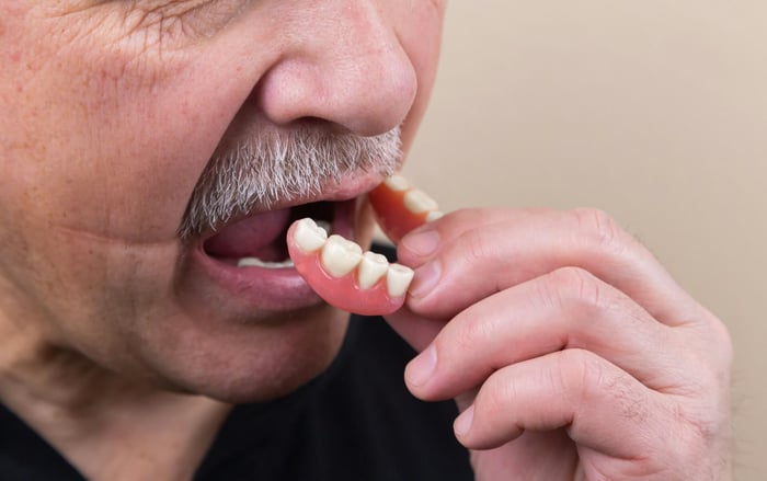 Benefits of All-on-4 Implants for Full-Arch Tooth Replacement