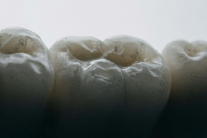 A closeup photo of a tooth