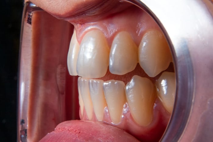 Do You Know How to Prepare for an Emergency Dentist Visit?