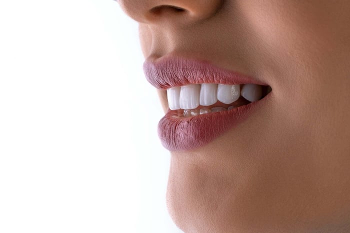 Close-up of a bright, healthy smile, illustrating the difference between Professional teeth whitening vs whitening strips